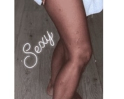 Kim Kardashian devoile ses jambes pleines de psoriasis